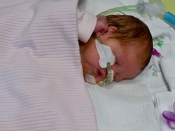 Łódź. Przełomowa operacja noworodka w Matce Polce w Łodzi. Ogromny guz usunęli 17 minut po porodzie