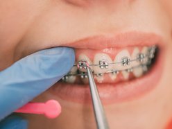 Łódź. TOP 10 ortodontów w Łodzi polecanych przez portal ZnanyLekarz.pl