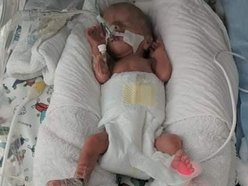 Łódź. Światowy Dzień Wcześniaka w Łodzi. Na zdjęciu Kordian, wcześniak urodzony w ICZMP w Łodzi