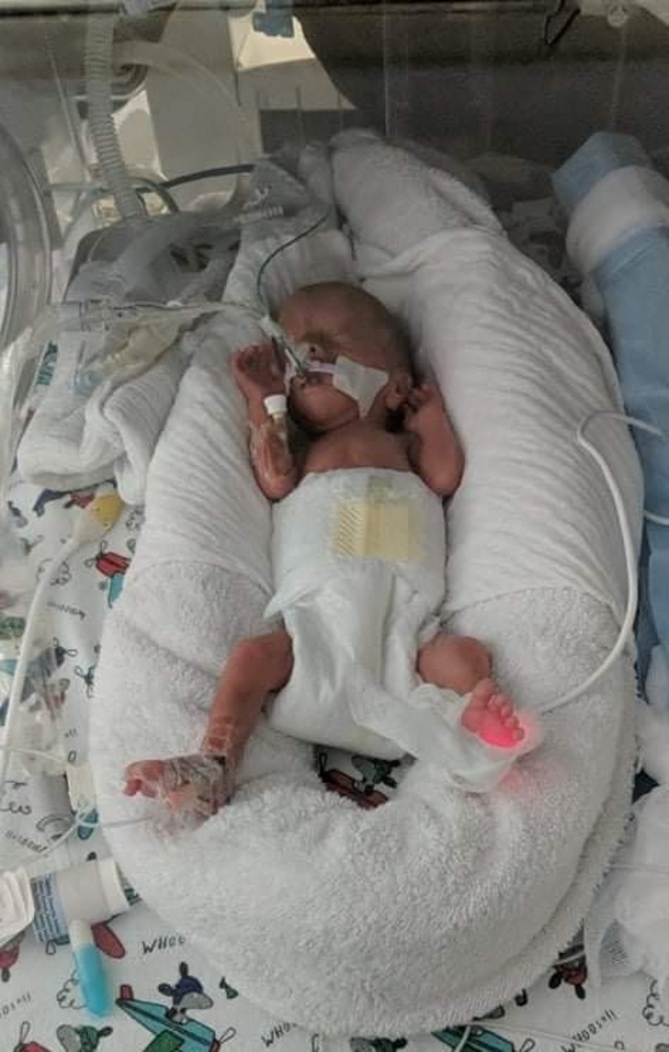 Łódź. Światowy Dzień Wcześniaka w Łodzi. Na zdjęciu Kordian, wcześniak urodzony w ICZMP w Łodzi