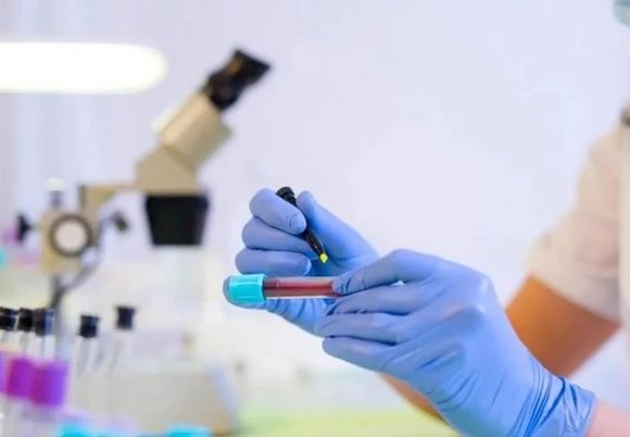 Łódź. Dzień Walki z AIDS