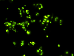 Łódź. Inteligentne kapsułki. Pomysł naukowców z Uniwersytetu Łódzkiego może zmienić chemioterapię!