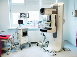 Najnowocześniejszy mammograf już w Łodzi. Szpital Kopernika ma nowy sprzęt!