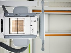 Łódź. Najnowocześniejsze RTG trafiło do Łodzi