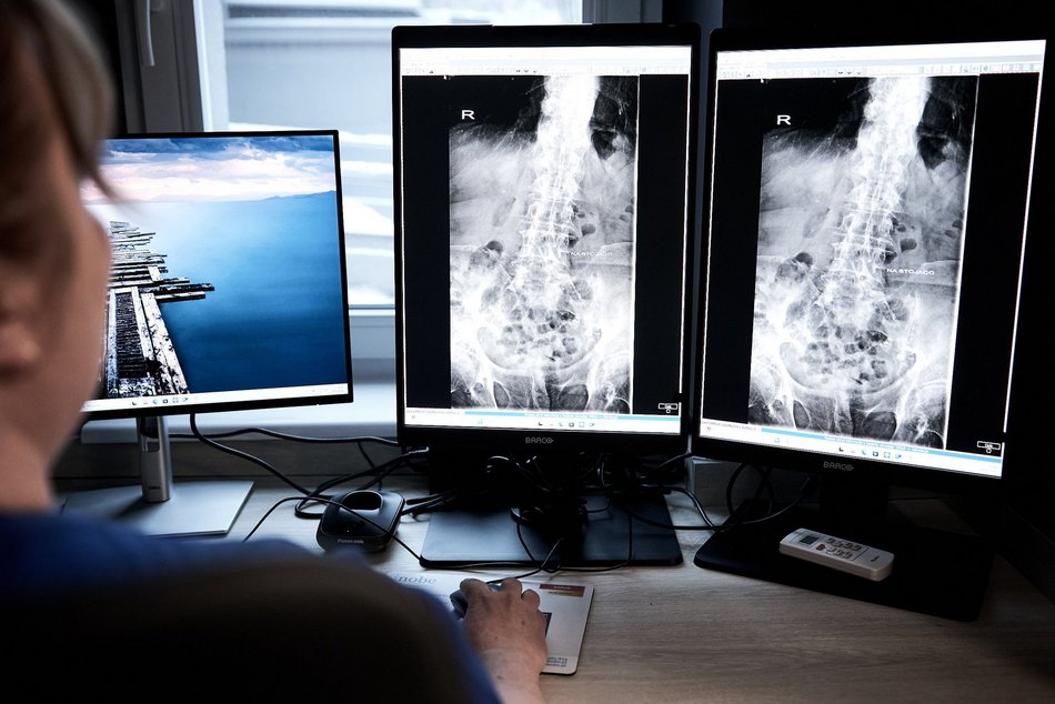 Łódź. Najnowocześniejsze RTG trafiło do Łodzi