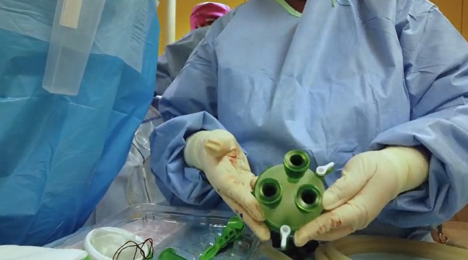 Innowacyjny zabieg w szpitalu Matki Polki w Łodzi. Nadzieja dla kobiet z rakiem piersi