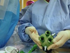 Innowacyjny zabieg w szpitalu Matki Polki w Łodzi. Nadzieja dla kobiet z rakiem piersi