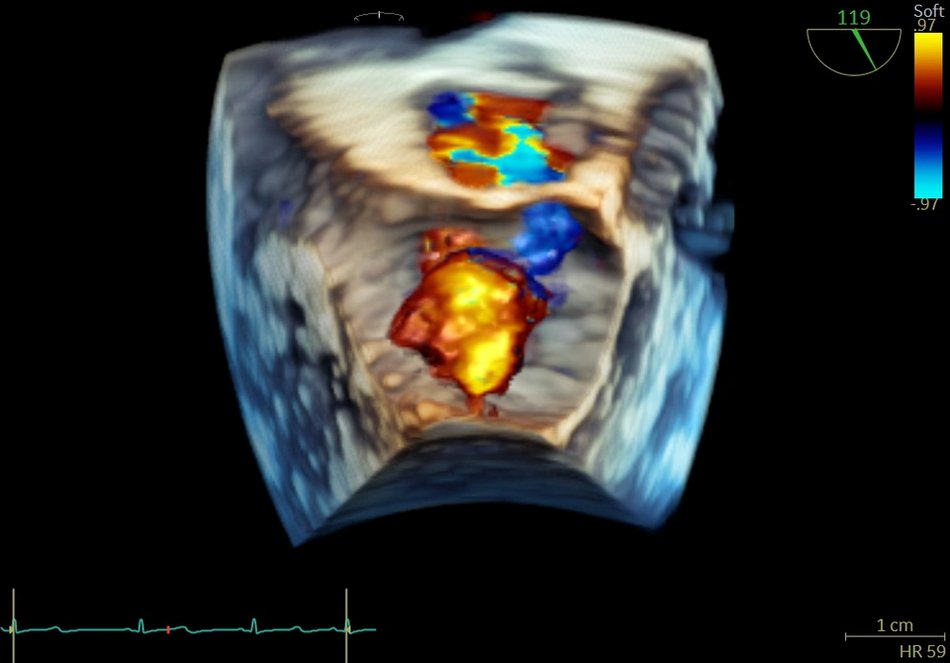 Łódź. Nowoczesny echokardiograf na Uniwersytecie Medycznym w Łodzi. Lepsza diagnostyka i leczenie